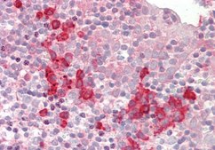 Anti-SNRPD1 antibody produced in rabbit affinity isolated antibody