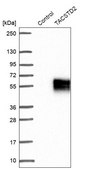 Anti-TACSTD2 antibody produced in rabbit Prestige Antibodies® Powered by Atlas Antibodies, affinity isolated antibody, buffered aqueous glycerol solution