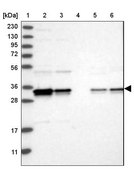 Anti-PDCL3 antibody produced in rabbit Prestige Antibodies® Powered by Atlas Antibodies, affinity isolated antibody, buffered aqueous glycerol solution