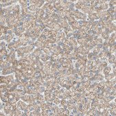 Anti-ACADL antibody produced in rabbit Prestige Antibodies® Powered by Atlas Antibodies, affinity isolated antibody, buffered aqueous glycerol solution