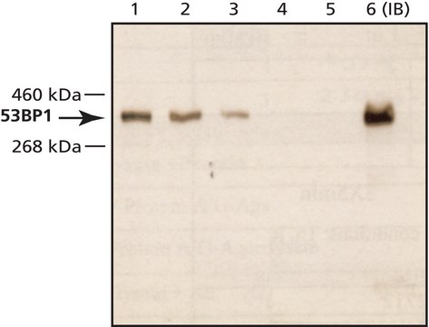 Anti-53BP1 (C-terminal) antibody produced in rabbit ~1&#160;mg/mL, affinity isolated antibody, buffered aqueous solution