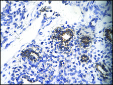 Anti-RPS16 (AB1) antibody produced in rabbit IgG fraction of antiserum