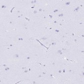 Anti-BPI antibody produced in rabbit Prestige Antibodies® Powered by Atlas Antibodies, affinity isolated antibody, buffered aqueous glycerol solution