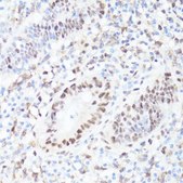 Anti-Phospho-c-Myc-S62 antibody produced in rabbit