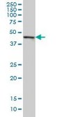 Monoclonal Anti-CMAS antibody produced in mouse clone 5A2, purified immunoglobulin, buffered aqueous solution