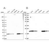 Anti-MT-CO2 antibody produced in rabbit Prestige Antibodies® Powered by Atlas Antibodies, affinity isolated antibody, buffered aqueous glycerol solution