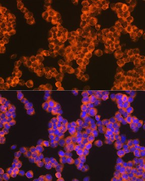 Anti-Oncostatin M Antibody, clone 8O8K9, Rabbit Monoclonal