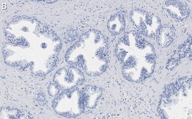 Anti-phospho-TSC2-Ser939 Antibody, clone 1G19 ZooMAb® Rabbit Monoclonal recombinant, expressed in HEK 293 cells