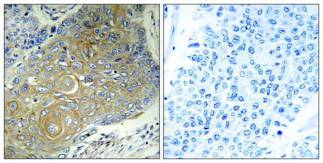 Anti-MRPS33 antibody produced in rabbit affinity isolated antibody