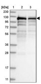Anti-SART1 antibody produced in rabbit Prestige Antibodies® Powered by Atlas Antibodies, affinity isolated antibody, buffered aqueous glycerol solution, ab2