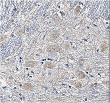 Anti-SUR1 Antibody, clone N289/16 clone N289/16, from mouse