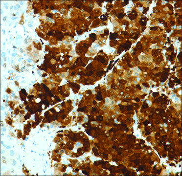 Anti-Arginase-1 antibody, Rabbit monoclonal clone SP156, recombinant, expressed in proprietary host, affinity isolated antibody