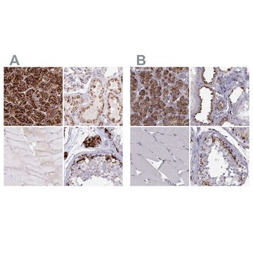 Anti-TPP1 antibody produced in rabbit Prestige Antibodies&#174; Powered by Atlas Antibodies, affinity isolated antibody, buffered aqueous glycerol solution