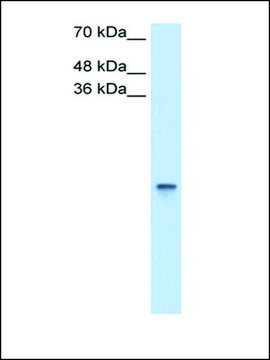 Anti-RBP1 antibody produced in rabbit IgG fraction of antiserum