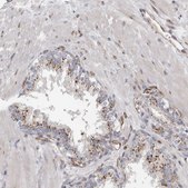 Anti-PEX6 antibody produced in rabbit Prestige Antibodies® Powered by Atlas Antibodies, affinity isolated antibody, buffered aqueous glycerol solution