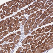 Anti-KIAA0408 antibody produced in rabbit Prestige Antibodies® Powered by Atlas Antibodies, affinity isolated antibody, buffered aqueous glycerol solution