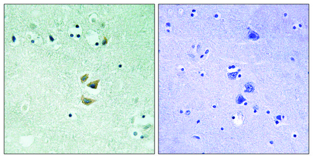 Anti-PRKCA antibody produced in rabbit affinity isolated antibody