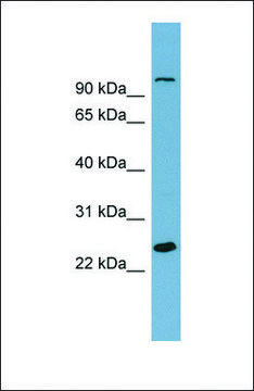 Anti-SEMA3D antibody produced in rabbit affinity isolated antibody