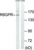 Anti-RAB3GAP2 antibody produced in rabbit affinity isolated antibody