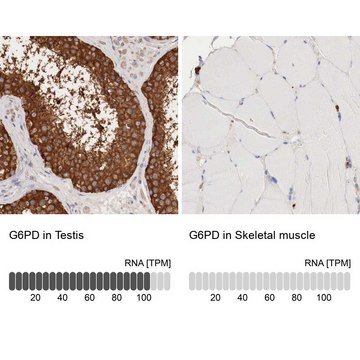 Anti-G6PD antibody produced in rabbit Prestige Antibodies&#174; Powered by Atlas Antibodies, affinity isolated antibody, buffered aqueous glycerol solution