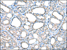 Anti-TIMM17A affinity isolated antibody