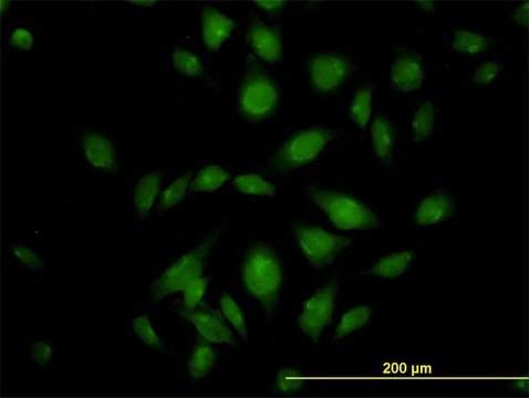 Monoclonal Anti-ATP2C1 antibody produced in mouse clone 2G1, purified immunoglobulin, buffered aqueous solution