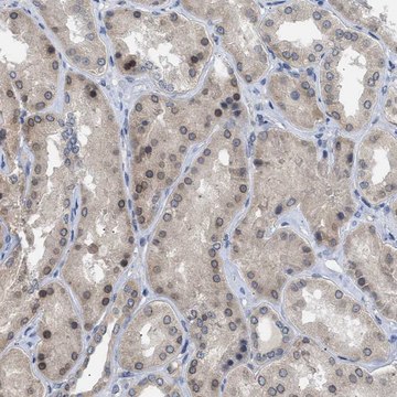 Anti-NUP93 antibody produced in rabbit Prestige Antibodies&#174; Powered by Atlas Antibodies, affinity isolated antibody, buffered aqueous glycerol solution