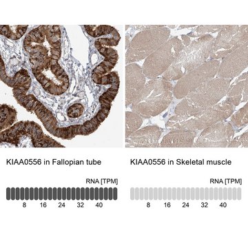 Anti-KIAA0556 antibody produced in rabbit Prestige Antibodies&#174; Powered by Atlas Antibodies, affinity isolated antibody, buffered aqueous glycerol solution