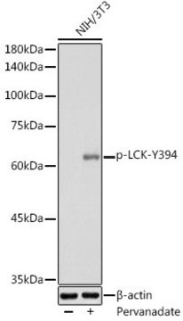 Anti-Phospho-LCK-Y394 antibody produced in rabbit