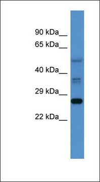 Anti-COMMD2 antibody produced in rabbit affinity isolated antibody