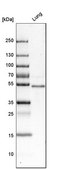 Anti-FOXF1 antibody produced in rabbit Prestige Antibodies® Powered by Atlas Antibodies, affinity isolated antibody, buffered aqueous glycerol solution