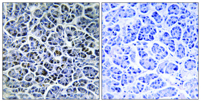 Anti-PPM1K antibody produced in rabbit affinity isolated antibody