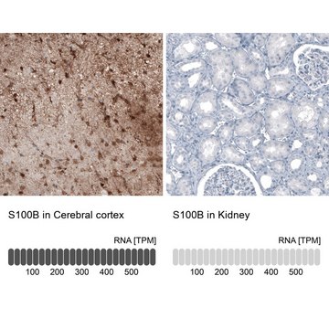 单克隆抗-S100B 小鼠抗 Prestige Antibodies&#174; Powered by Atlas Antibodies, clone CL2720, purified immunoglobulin, buffered aqueous glycerol solution