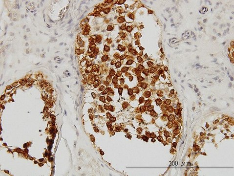 Monoclonal Anti-DAZ1 antibody produced in mouse clone 3A4, purified immunoglobulin, buffered aqueous solution