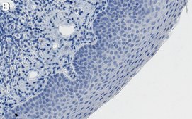 Anti-ASXL2 Antibody, clone 1D5 ZooMAb® Rabbit Monoclonal recombinant, expressed in HEK 293 cells