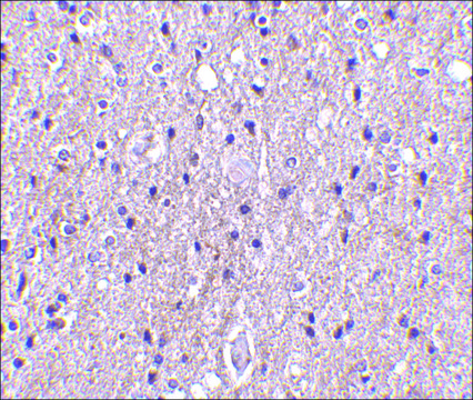 Anti-CTRP4 (ab2) antibody produced in rabbit affinity isolated antibody, buffered aqueous solution