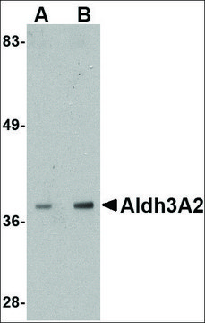 Anti-Aldh3A2 antibody produced in rabbit affinity isolated antibody, buffered aqueous solution