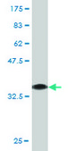 Monoclonal Anti-LYPLA1 antibody produced in mouse clone 3D5, purified immunoglobulin, buffered aqueous solution