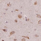 Anti-RPS5 antibody produced in rabbit Prestige Antibodies® Powered by Atlas Antibodies, affinity isolated antibody