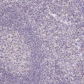 Anti-SLC6A18 antibody produced in rabbit Prestige Antibodies® Powered by Atlas Antibodies, affinity isolated antibody, buffered aqueous glycerol solution