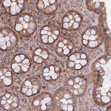 Anti-METTL13 antibody produced in rabbit Prestige Antibodies&#174; Powered by Atlas Antibodies, affinity isolated antibody, buffered aqueous glycerol solution