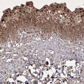 Anti-PLEKHM2 antibody produced in rabbit Prestige Antibodies&#174; Powered by Atlas Antibodies, affinity isolated antibody, buffered aqueous glycerol solution