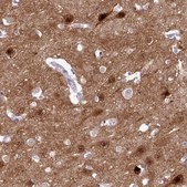 Anti-KCTD16 antibody produced in rabbit Prestige Antibodies® Powered by Atlas Antibodies, affinity isolated antibody, buffered aqueous glycerol solution