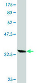 Monoclonal Anti-AKR1B10 antibody produced in mouse clone 2B3, purified immunoglobulin, buffered aqueous solution