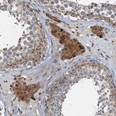 Anti-TCTN1 antibody produced in rabbit Prestige Antibodies® Powered by Atlas Antibodies, affinity isolated antibody, buffered aqueous glycerol solution