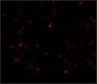 Anti-AIM (ab2) antibody produced in rabbit affinity isolated antibody, buffered aqueous solution
