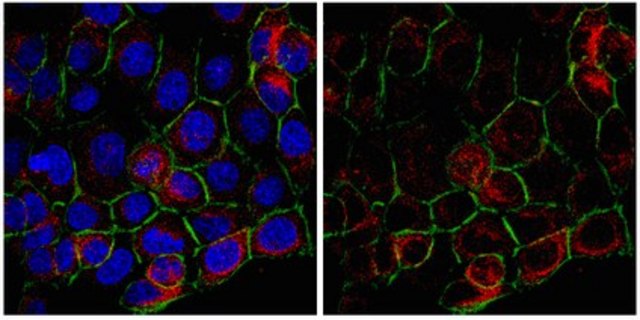 Anti-Tensin-3 Antibody from rabbit, purified by affinity chromatography