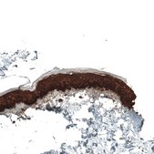 Monoclonal Anti-KRT5 antibody produced in mouse Prestige Antibodies® Powered by Atlas Antibodies, clone CL9297, purified immunoglobulin, buffered aqueous glycerol solution