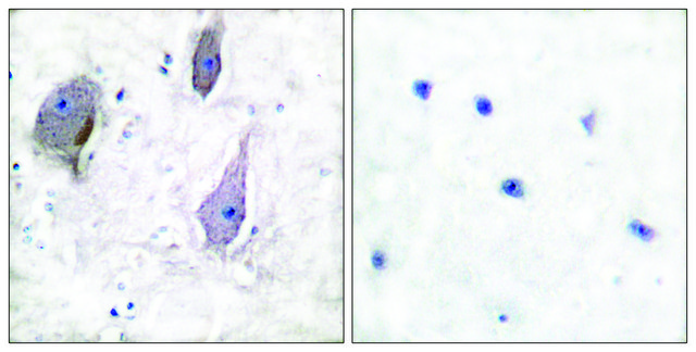 Anti-PMP22 antibody produced in rabbit affinity isolated antibody