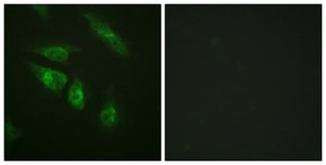 Anti-NFAT3 antibody produced in rabbit affinity isolated antibody
